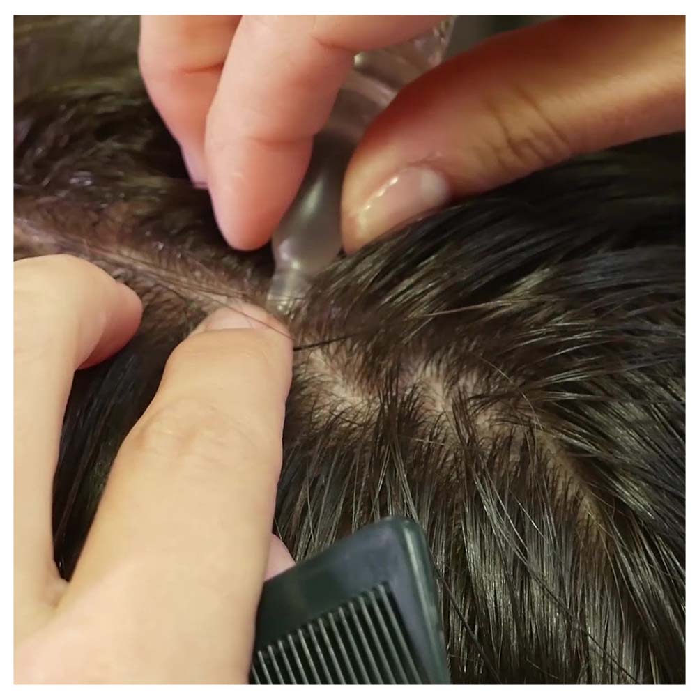 ¡50% DTO! 2a Unidad Ampollas STOP CAÍDA 14 DÍAS