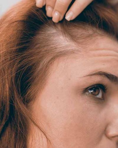 ¿Te preocupan tus entradas? ¡Te damos las claves para evitarlas!