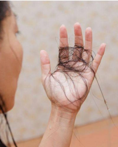 ¿Por qué me sigue cayendo cabello?