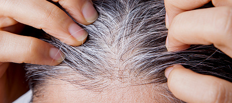 ¿Podemos prevenir la aparición de canas?