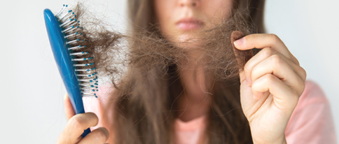 Efluvio telógeno agudo