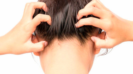 La psoriasis: ¿puede provocar caída del cabello?