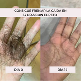 PACK Recupera tu melena en 14 días 30% DTO (Ampollas, Champú, Mascarilla BLOOM GRATIS)