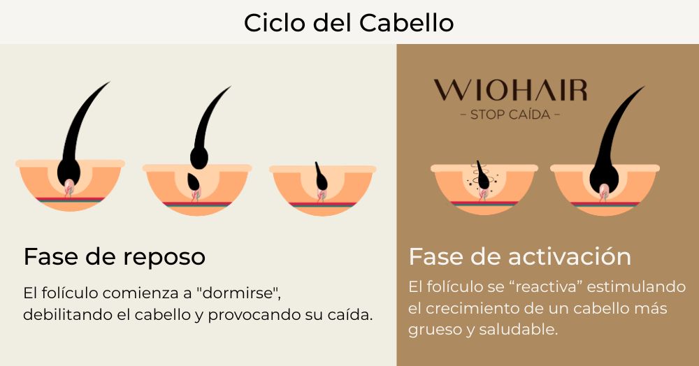 Imagen que habla sobre el ciclo del cabello, primero la fase de reposo donde el cabello empieza a caerse, y luego el efecto de los productos de Wiohair, que reactivan el folículo.