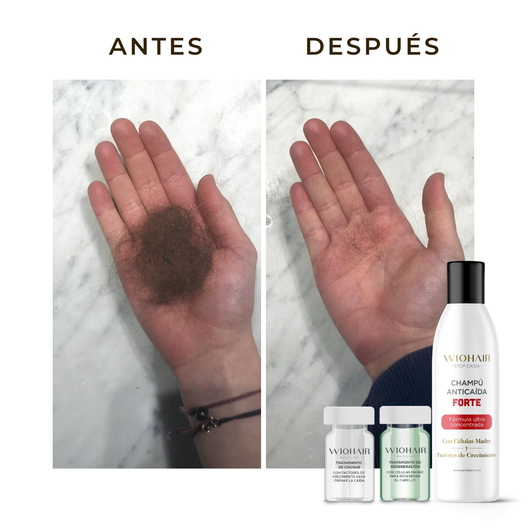 ¡50% DTO! 2a Unidad Ampollas STOP CAÍDA 14 DÍAS