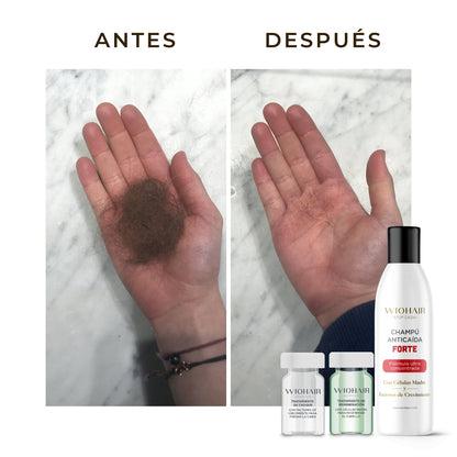 ¡50% DTO! 2a Unidad Ampollas STOP CAÍDA 14 DÍAS